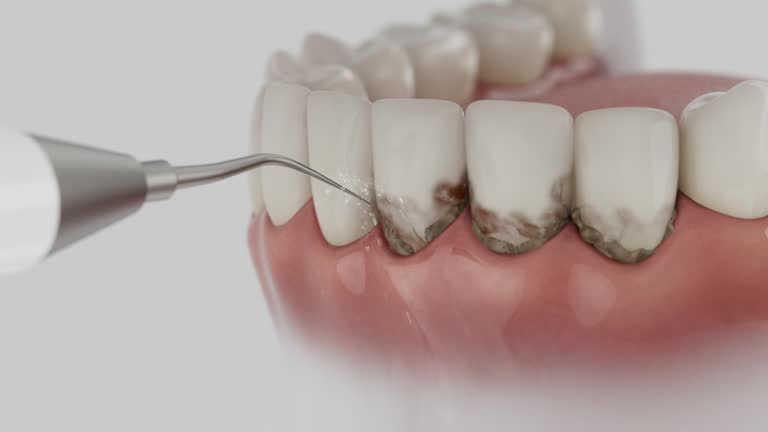 Trusted Dental Implants service in East Bakersfield, CA - Dentist Open Now